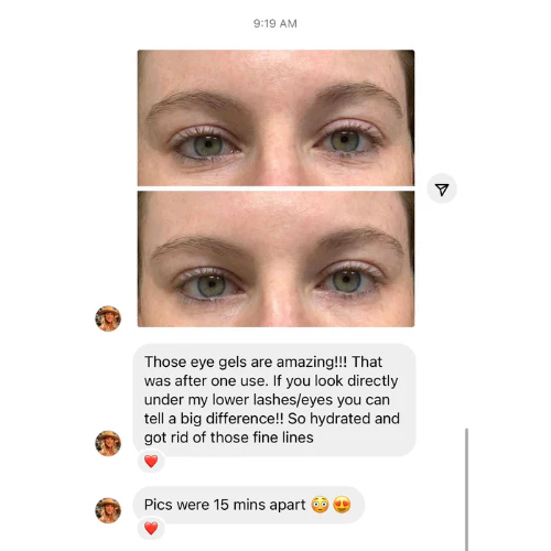 Cactus Collagen Under Eye Gels with cooling Aloe - Image 5
