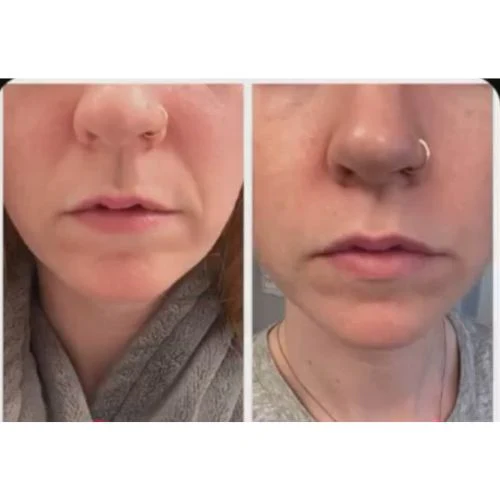 Corners of Eyes & Mouth Facial Patches - Image 10