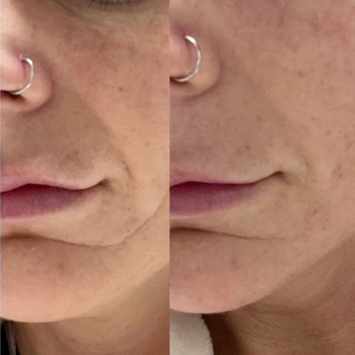Corners of Eyes & Mouth Facial Patches - Image 7