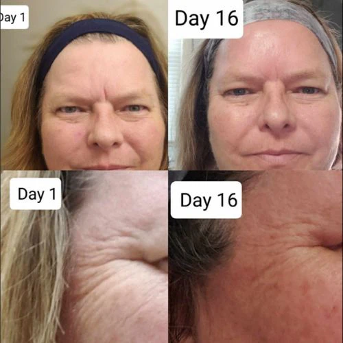 Corners of Eyes & Mouth Facial Patches - Image 8