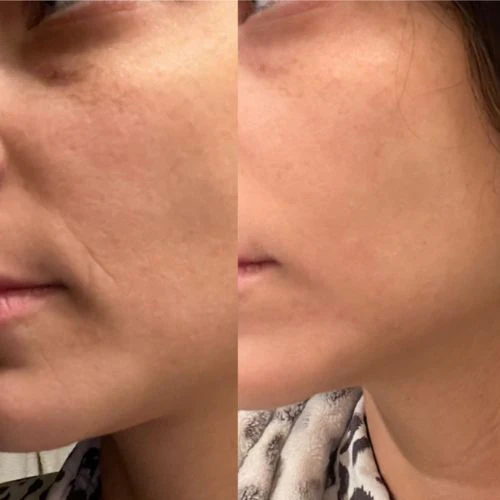 Corners of Eyes & Mouth Facial Patches - Image 9
