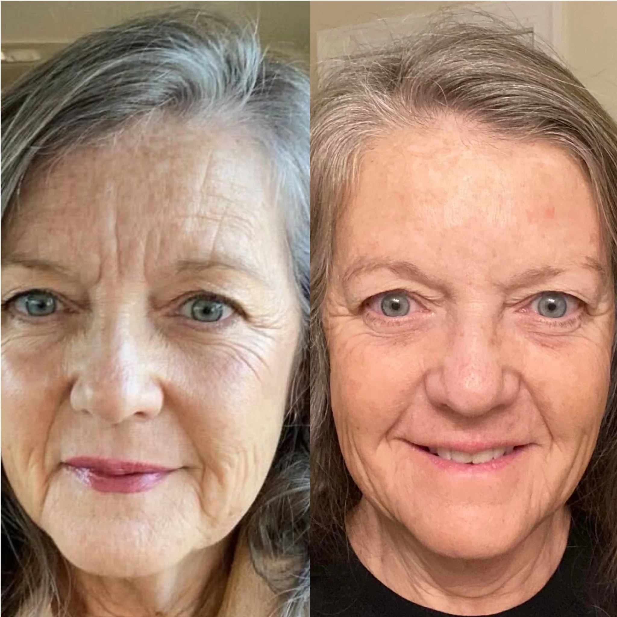 Facial Patches with Rosewater Hydrator Spray - Image 10