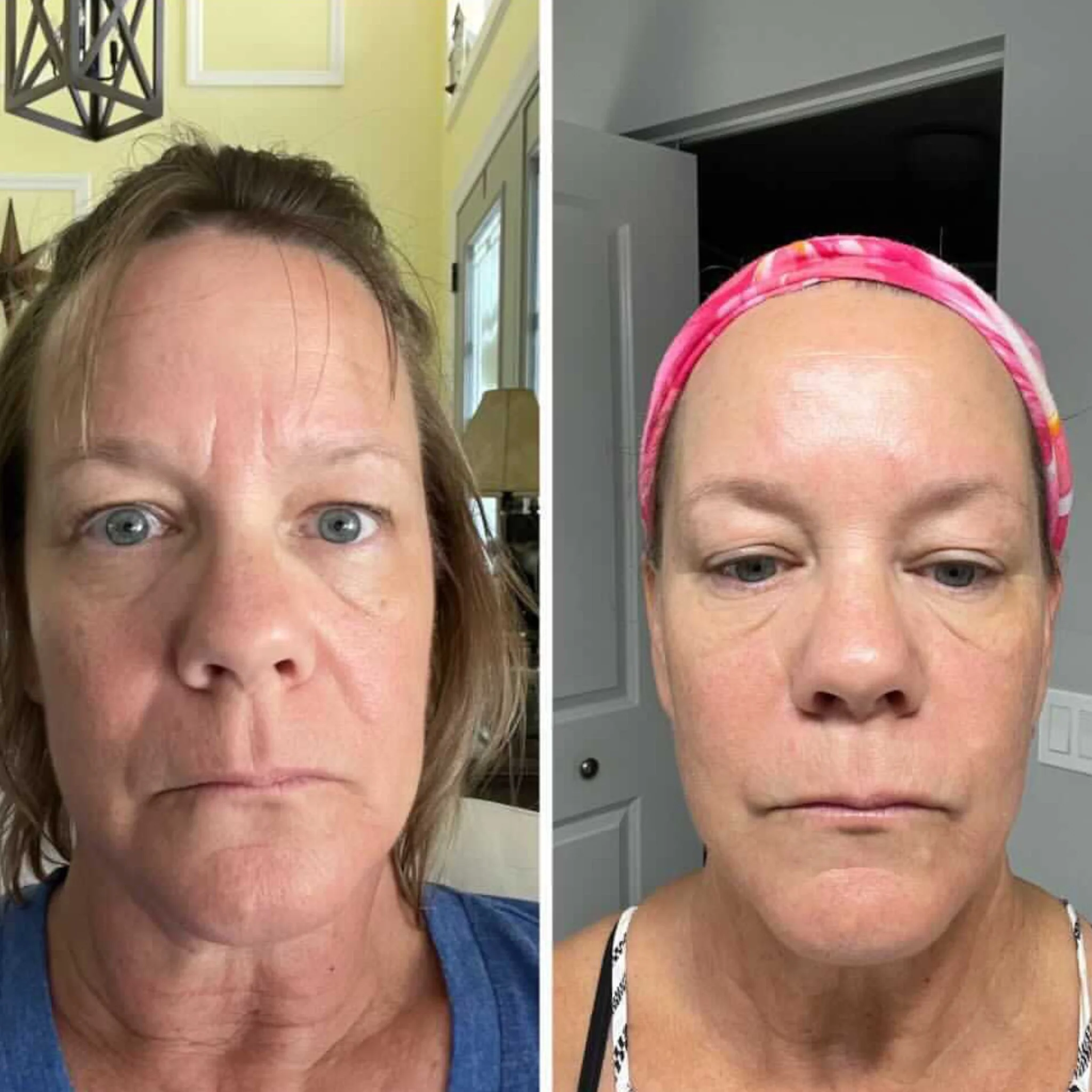 Facial Patches with Rosewater Hydrator Spray - Image 11
