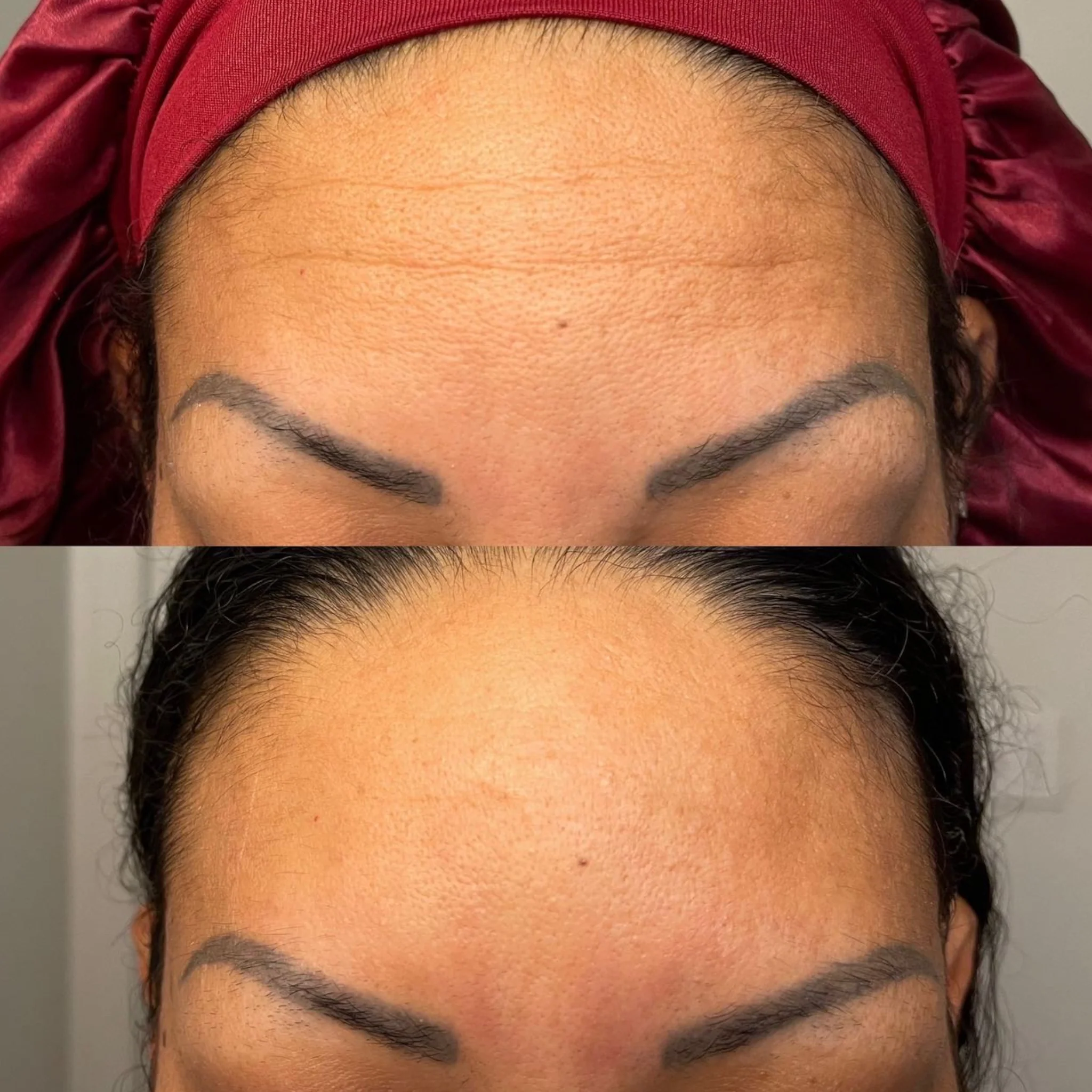 Facial Patches with Rosewater Hydrator Spray - Image 12