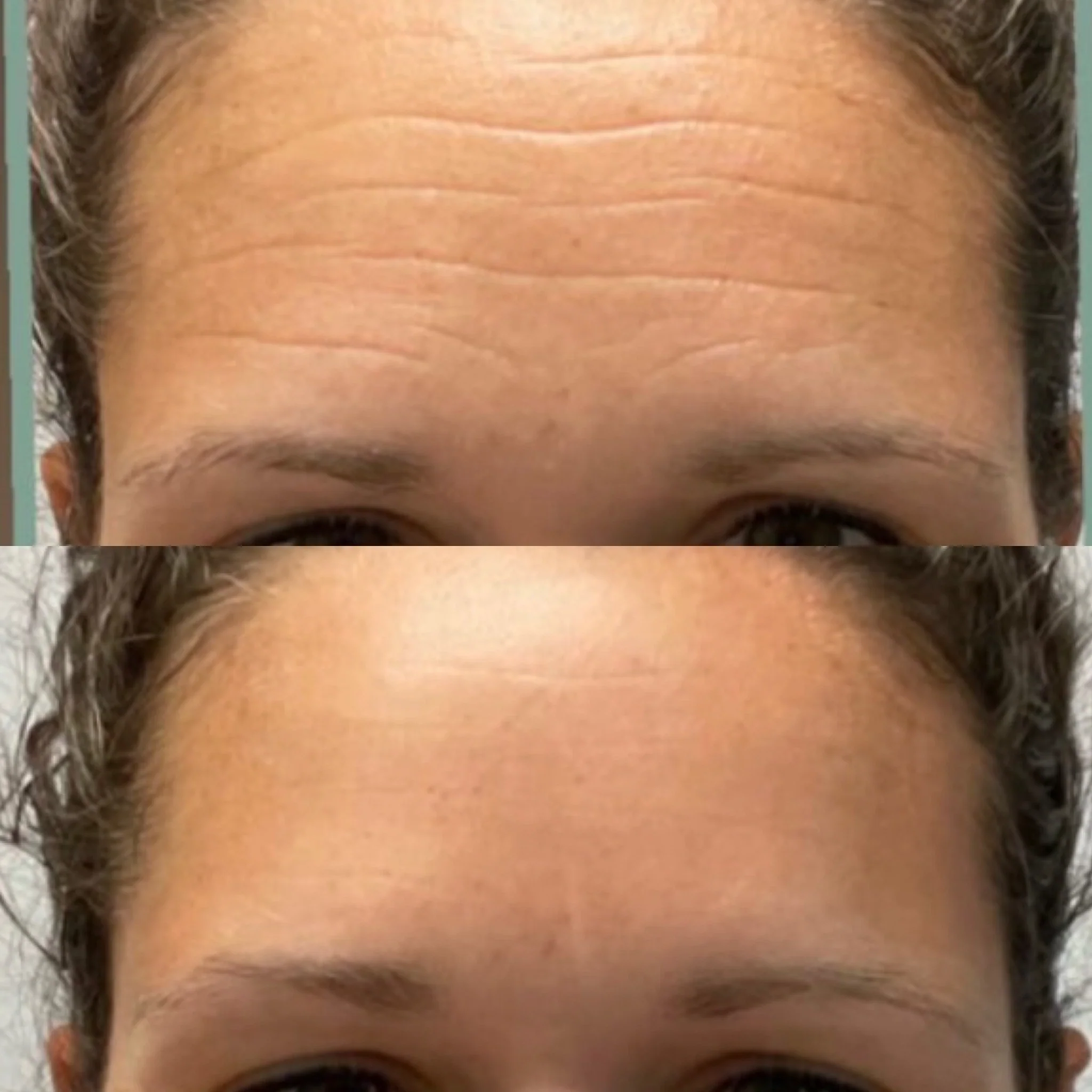 Facial Patches with Rosewater Hydrator Spray - Image 13