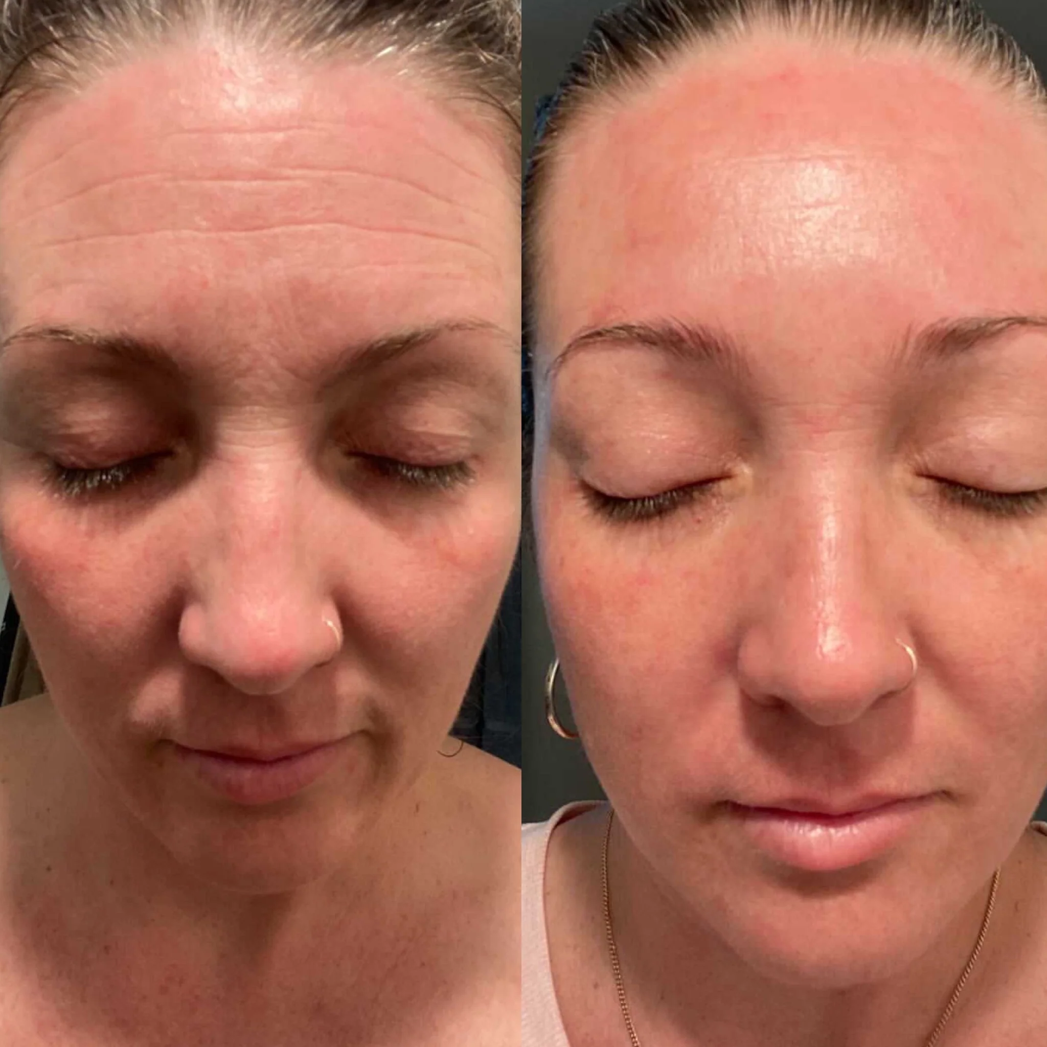 Facial Patches with Rosewater Hydrator Spray - Image 14