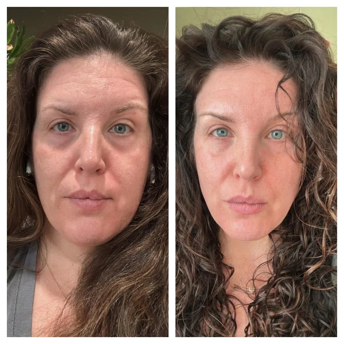 Forehead & Between Eyes Facial Patches - Image 5