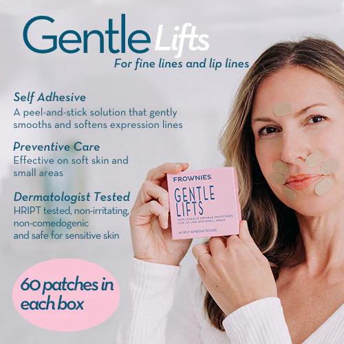 Gentle Lifts for Lip Lines - Image 3