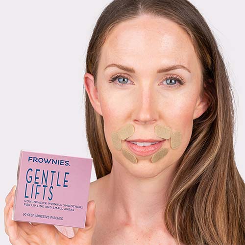 Gentle Lifts for Lip Lines - Image 7