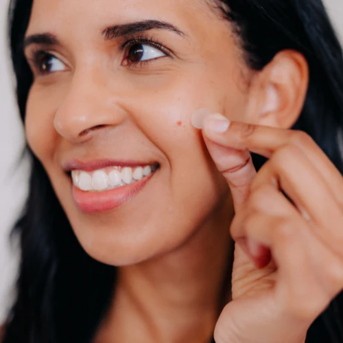 Pimple Patches with Salicylic Acid - Image 3
